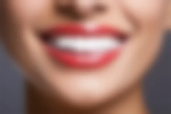 昆明尚爱韩美口腔(北京路门诊)限时优惠，牙套原价3880元起，现仅需2880元起，让您轻松拥有迷人自信的笑容！机会难得，快来咨询吧！