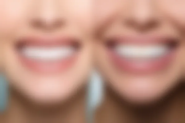 2026年杭州亮贝美口腔医院真实评价，看看大家对这家医院的看法和体验如何