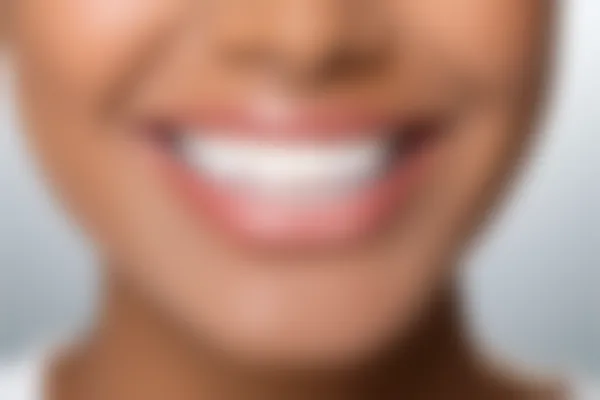 东营青橙口腔门诊部洗牙活动现仅需198元起，原价298元起，尽享口腔护理，体验超值洗牙服务！