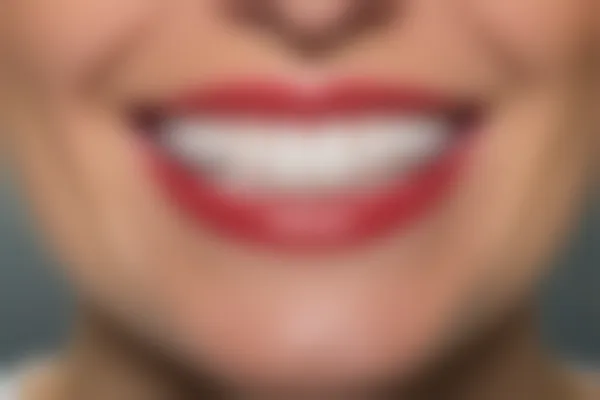 泉州丰泽维乐口腔医院评价如何？真实反馈与服务质量一览，值得一试的选择！