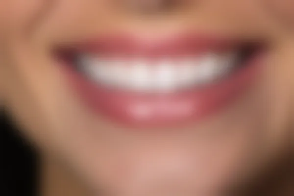 武汉博华口腔门诊部推出限时优惠活动，牙套价格从5000元起降至特价3500元起！