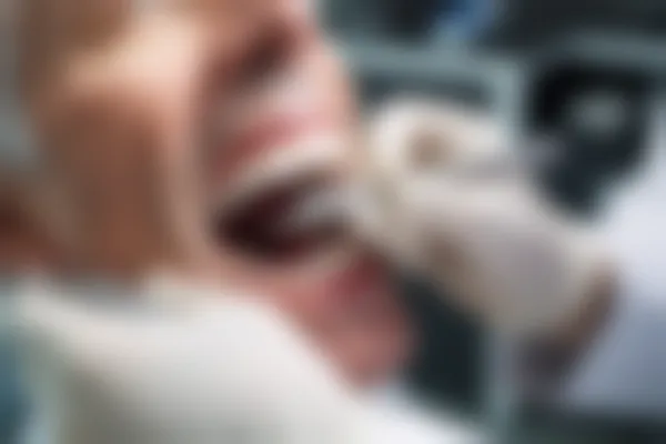 长春华植口腔门诊部拔牙优惠价仅需400元起，原价600元起，助您轻松解决口腔问题，享受实惠服务。