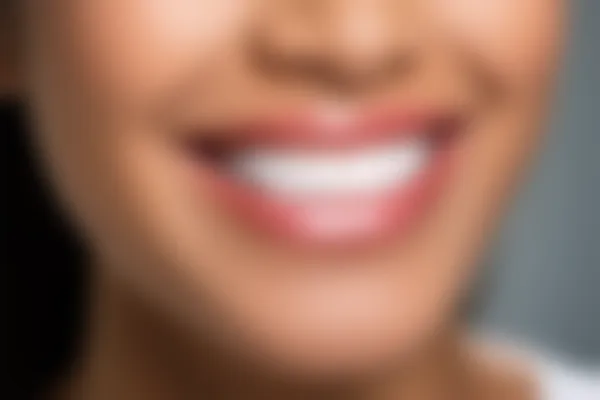 超值优惠！菏泽曹县雅美口腔诊所牙周治疗仅需600元起，原价800元起。