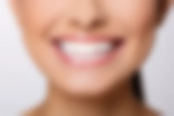 西安科恩高新口腔门诊牙套价格详细信息：原价3000元起，现享受限时优惠仅需2500元起，优异机会不容错过！