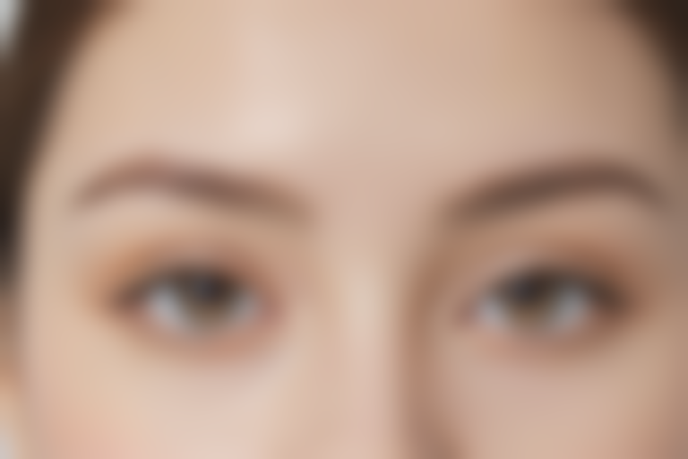 忻州美神整形医疗美容门诊部鱼尾纹去除服务现价仅需1500元起，原价为2000元起，优惠力度大！