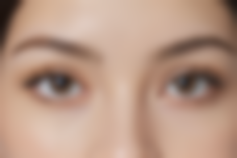 衡水尚艾美医疗美容门诊部激光祛斑价格表：原价2980元起，现在优惠仅需1980元起，优异机会，速来促销！