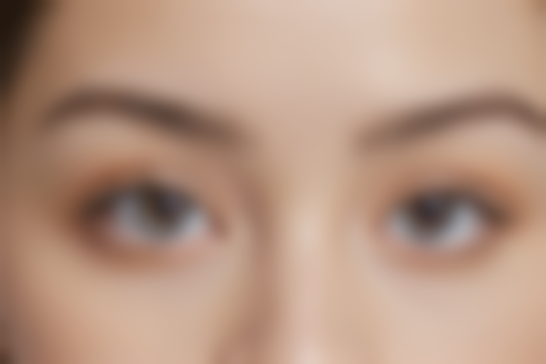 绵阳朗睿整形美容医院假体垫眉弓现价仅需4800元起，原价5800元起，优惠活动不容错过，赶快行动吧！