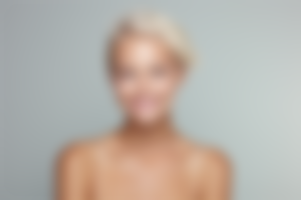 衢州衢化医院美容效果如何？面部整形手术真实体验分享