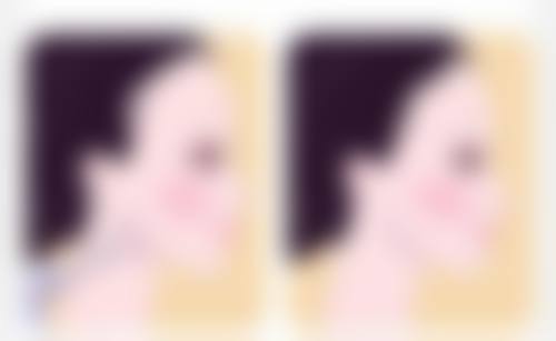 武汉光泽皇后医疗美容门诊部真人口碑评价