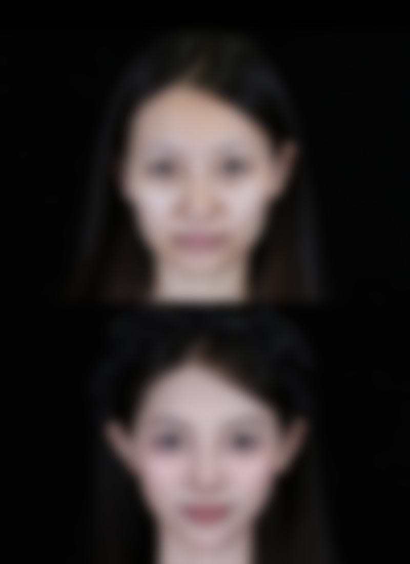 赵伟医生项目收费价格