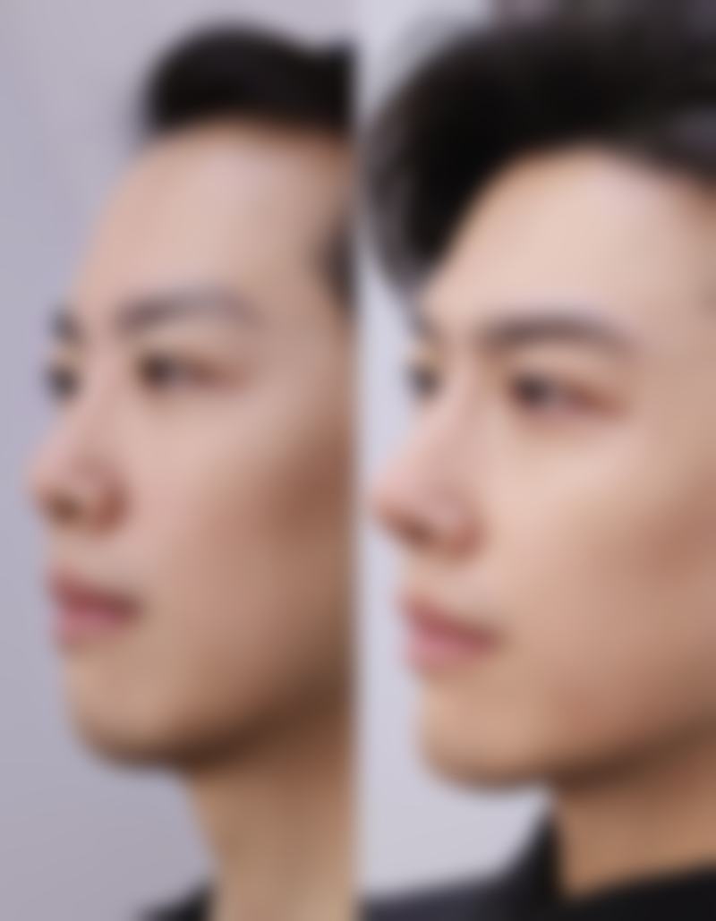 赵伟医生技术优势