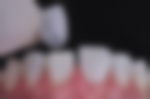 安阳北关添悦口腔门诊部预约挂号方式