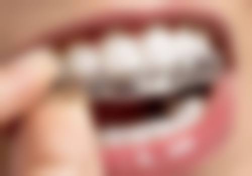 杭州九和医院(矫正种植修复中 心)收费价格表