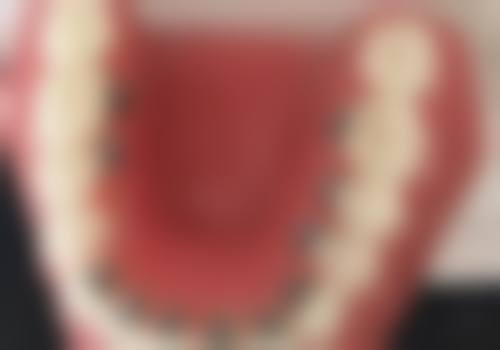 深圳鹏程新美姿口腔（羅湖口岸店）收费价格表