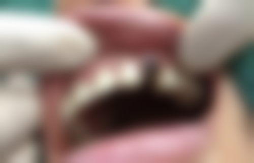 淮南刘长海口腔诊所收费价格表