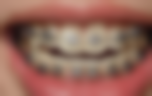 汪琪医生预约挂号