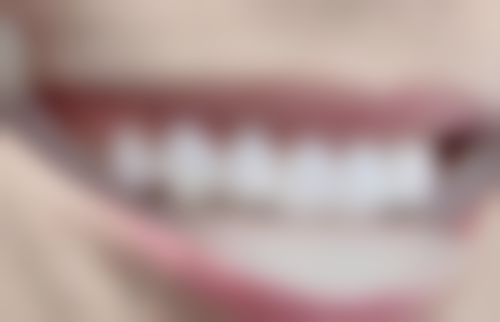 汪琪医生技术优势