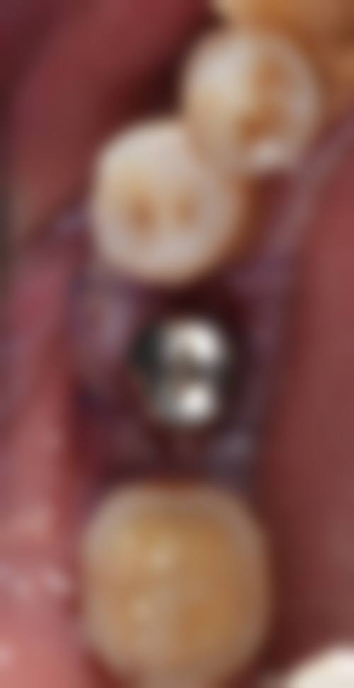 谢振医生口碑评价及反馈内容