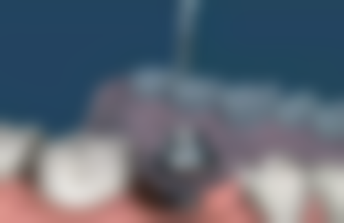 上海尤旦口腔连锁(浦东新区惠南店)预约挂号方式