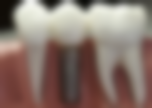 新疆喀什伊利哈口腔预约挂号方式