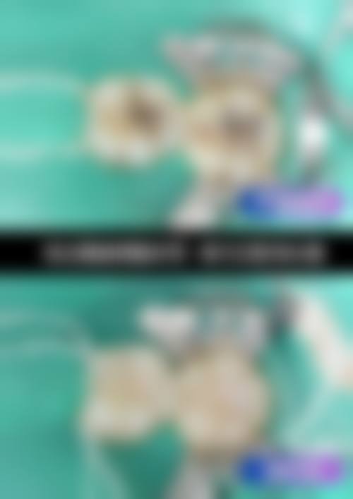 四川省人民医院儿童口腔科收费价格表