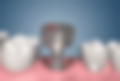 西安健齿象雅之道口腔门诊部特色诊疗项目与技术优势