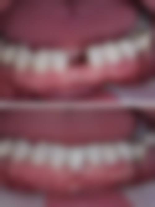 连云港灌南程映霞口腔收费价格表