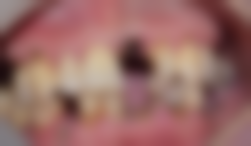 吉林市鑫鼎口腔收费价格表