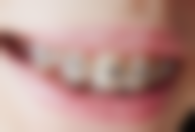 伊犁霍城县福宏林口腔收费价格表