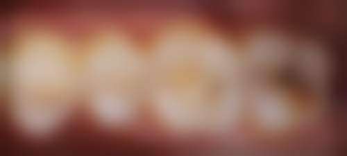 江苏无锡牙管家口腔收费价格表