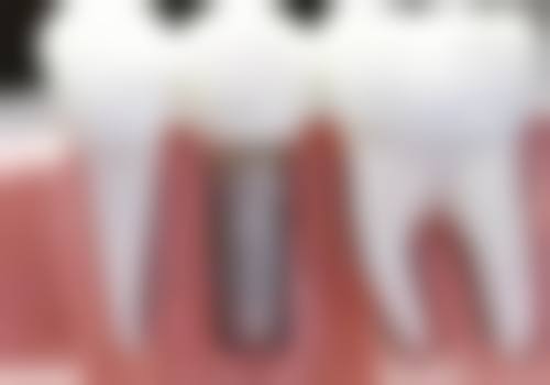 大同麦芽口腔门诊部收费价格表