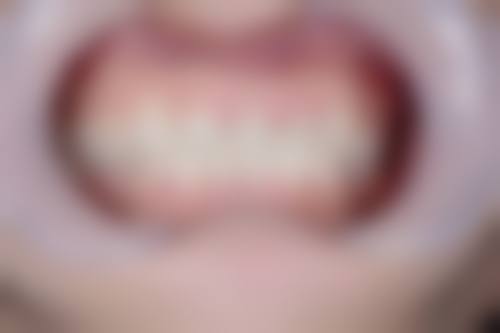 何玉凤医生技术优势