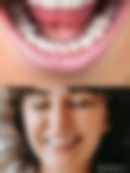 魏运涛医生项目收费价格