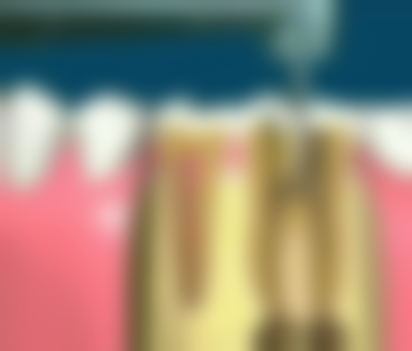 宋珊医生技术优势