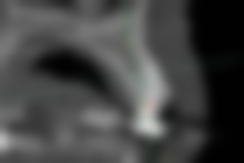 柳州阙医生口腔诊所特色诊疗项目与技术优势