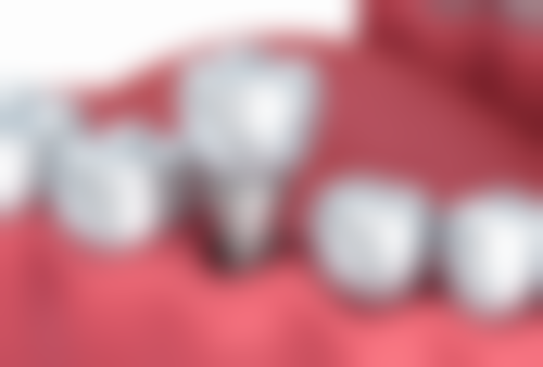 山东济南高新优铂口腔预约挂号方式