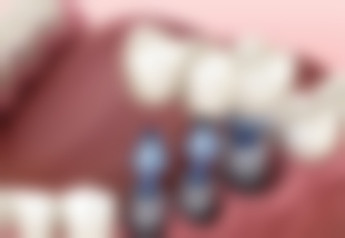 江苏镇江大港卓越口腔门诊部预约挂号方式