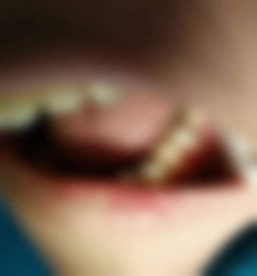 尚雅口腔(番禺店)收费价格表