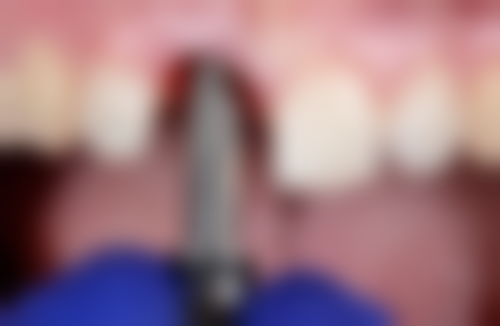 浙江温州乐清吴乐飞口腔特色诊疗项目与技术优势