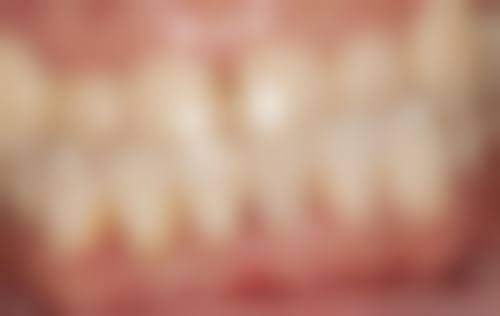 湖南长沙望城齿盟时代口腔门诊部特色诊疗项目与技术优势