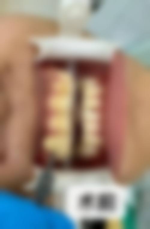 深圳羅湖麥芽口腔醫院收费价格表