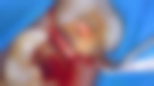 赵敏医生技术优势