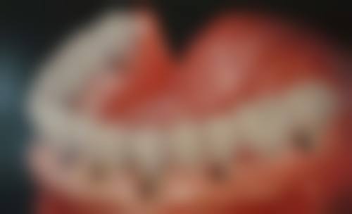 赵敏医生项目收费价格