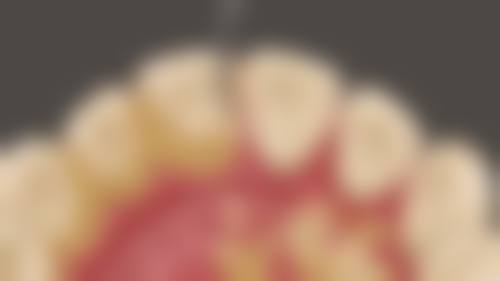 刘瑜睿医生技术优势