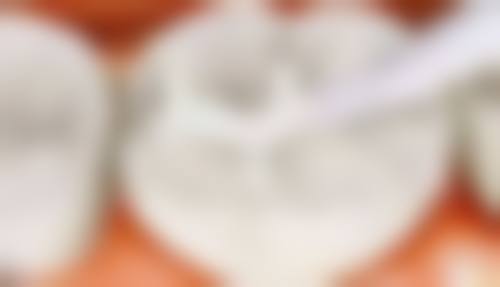 赵敏医生技术优势