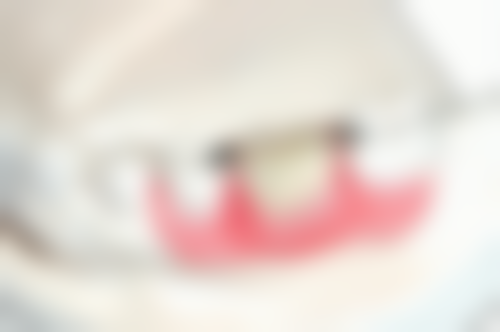 方晓燕医生项目收费价格