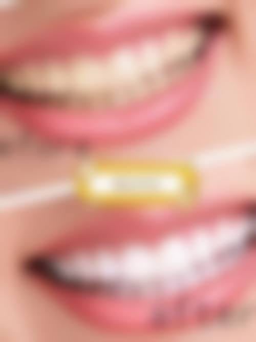 东莞口腔医院收费价格表