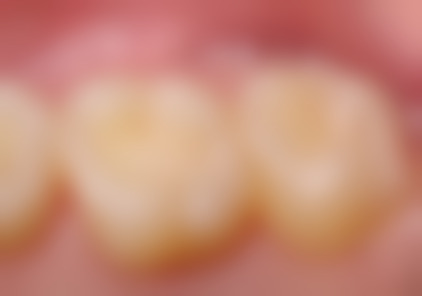 河南开封河川口腔门诊部预约挂号方式