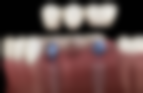 山东济宁幸福口腔特色诊疗项目与技术优势