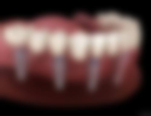 西宁杨泽红美容牙科收费价格情况